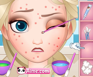 game Squeeze Elsa Pimples